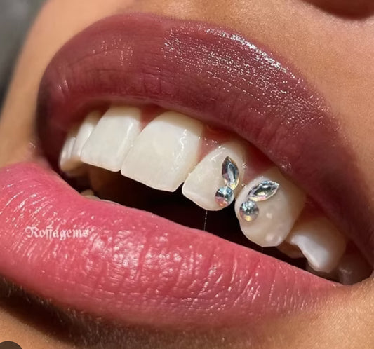 Butterfly tooth gem design